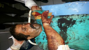 Injured Ramgarh route bus agent. —Excelsior/Gautam