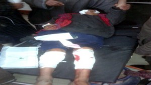 One of the injured in blast at Shopian on Thursday. -Excelsior/Younis Khaliq