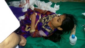 A girl injured in grenade blast at Shopian on Saturday. Another pic on page 6.— Excelsior / Younis Khaliq