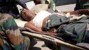 A BSF jawan injured in Balakote sector of Poonch being treated in hospital.