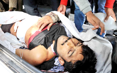 One of the victims of militant firing in Arnia. -Excelsior/Rakesh