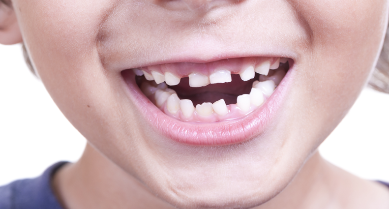 Irregular teeth linked to poor posture, balance control: study