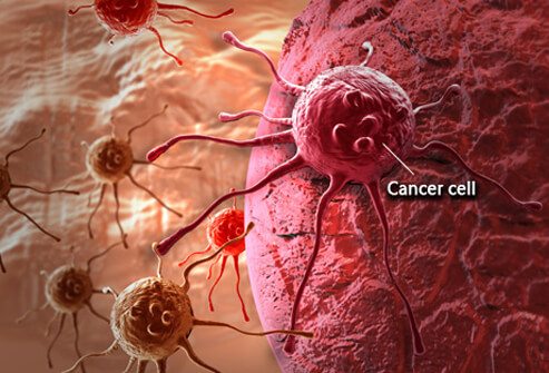 cancer-101-s1-what-is-cancer-cell