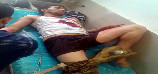 Civilian injured in Kishtwar blast admitted in the District Hospital on Tuesday. -Excelsior/Tilak Raj Civilian injured in Kishtwar blast admitted in the District Hospital on Tuesday. -Excelsior/Tilak Raj