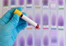 Casual medical approach increases abandoned insane people