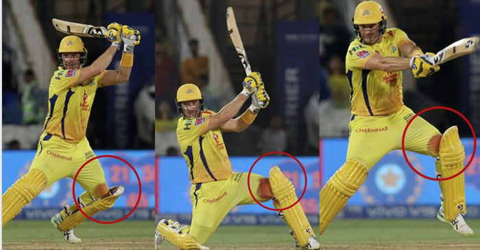Shane Watson Blooded leg