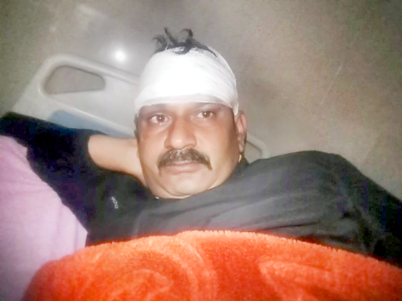 SHO Kathua Manjit Singh under going treatment at GMC Kathua on Wednesday. SHO Kathua Manjit Singh under going treatment at GMC Kathua on Wednesday.