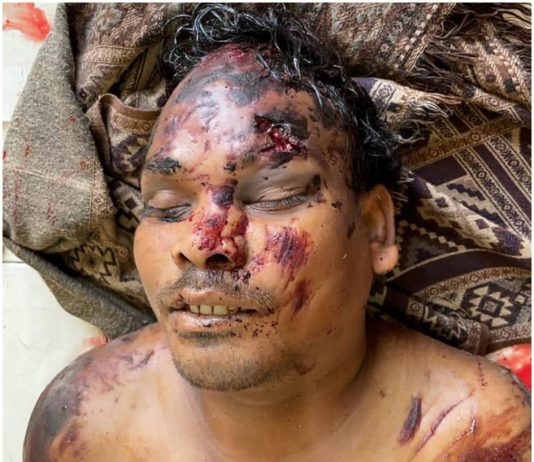 Police seeks help to identify dead body - Jammu Kashmir Latest News