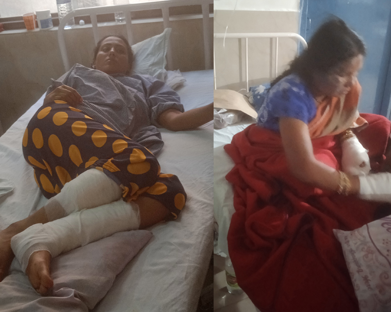 Victims of Katra bus incident undergoing treatment at GMCH Jammu. Victims of Katra bus incident undergoing treatment at GMCH Jammu.