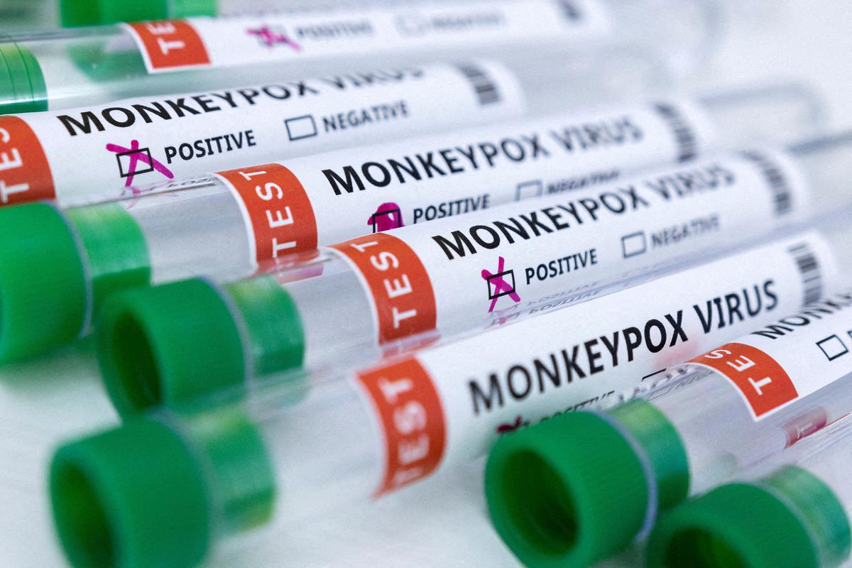 Monekypox