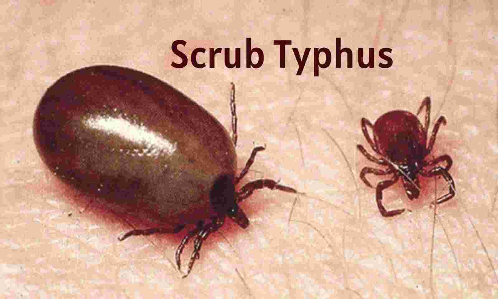 scrub typhus