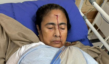 Mamata Banerjee Suffers Major Injury, Admitted To Hospital Mamata Banerjee Suffers Major Injury, Admitted To Hospital