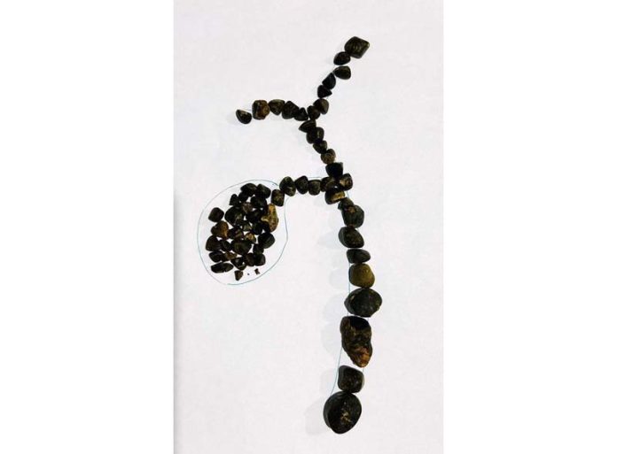 Extracted stones arranged in a specific design.