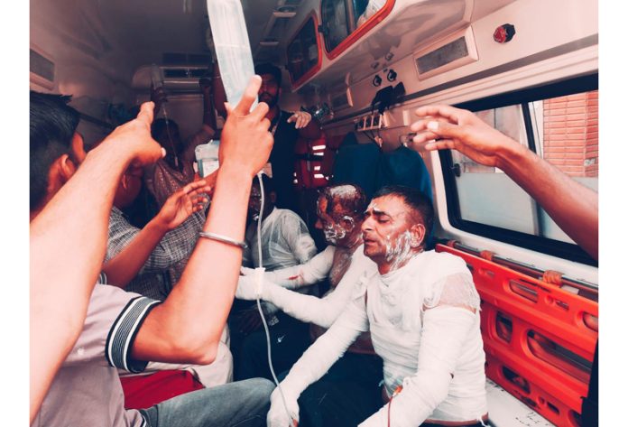 Three workers who received burn injuries in the industrial area at Samba being shifted to GMC, Jammu for treatment on Monday.