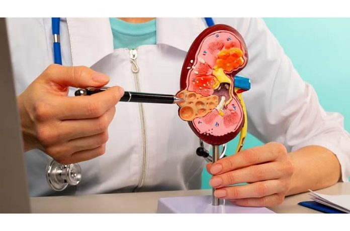 J&K surgeon among two still absconding in Kidney Transplantation racket at Hyderabad J&K surgeon among two still absconding in Kidney Transplantation racket at Hyderabad