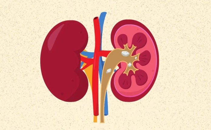 Chronic Kidney Disease Often Goes Undiagnosed, But Early Detection Can Prevent Severe Outcomes