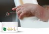 Weather Change Bringing More Mosquitoes? Heal Bug Bites Naturally with Mother Sparsh After Bite Turmeric Balm
