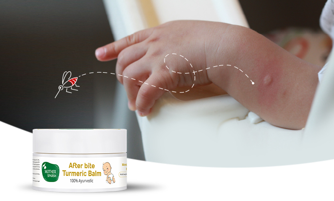 Weather Change Bringing More Mosquitoes? Heal Bug Bites Naturally with Mother Sparsh After Bite Turmeric Balm Weather Change Bringing More Mosquitoes? Heal Bug Bites Naturally with Mother Sparsh After Bite Turmeric Balm