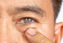 Air Pollution Increases Risk Of Eye Infection, Other Ocular Problems, Say Doctors