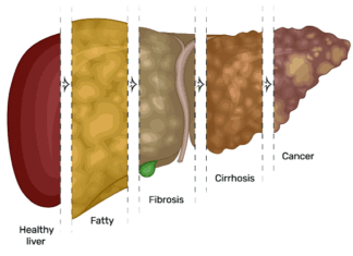 When the Liver Calls for Help