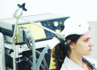 Healing the brain sans surgery The rise of TMS