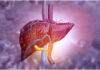 1.3 bn people had liver disease globally in 2023: Lancet study