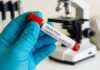India Issues Ebola Advisory For Passengers Arriving From High-Risk African Nations