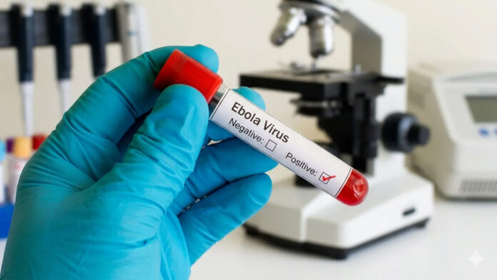 EBOLA