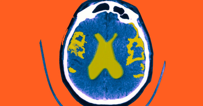 health