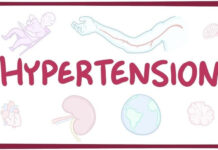 More than 1.7 billion adults globally had hypertension in 2020: Analysis